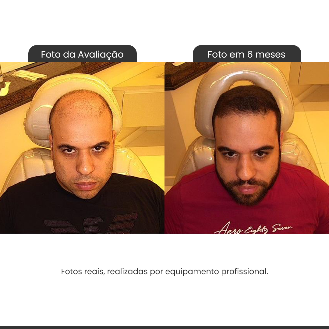 primeira