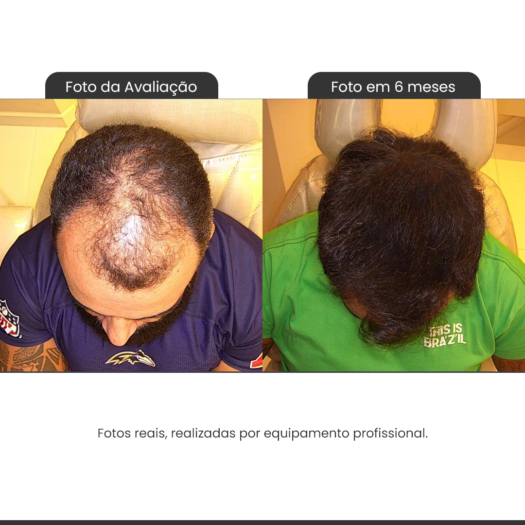 quarta