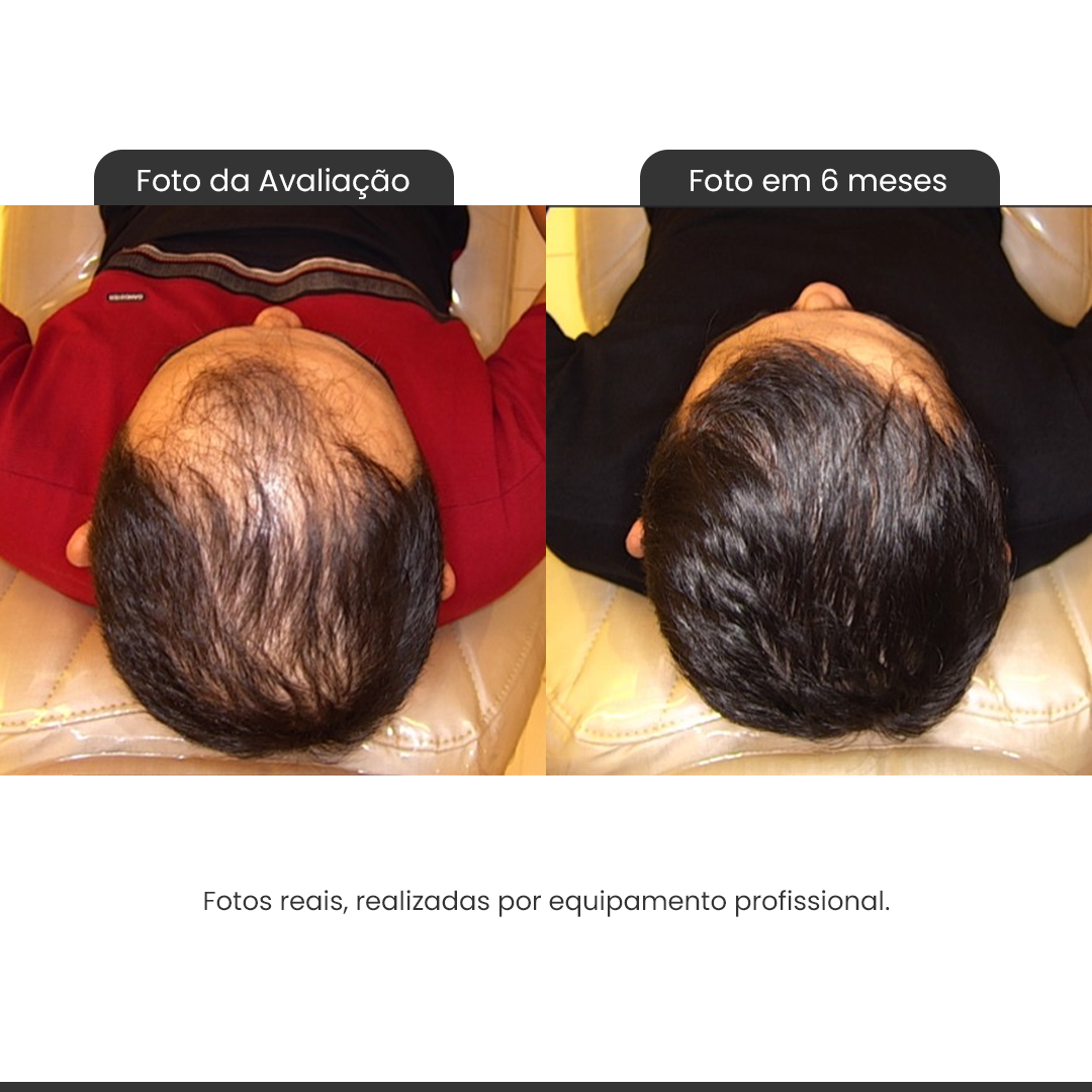 terceira